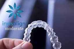 Invisalign Moderateの画像